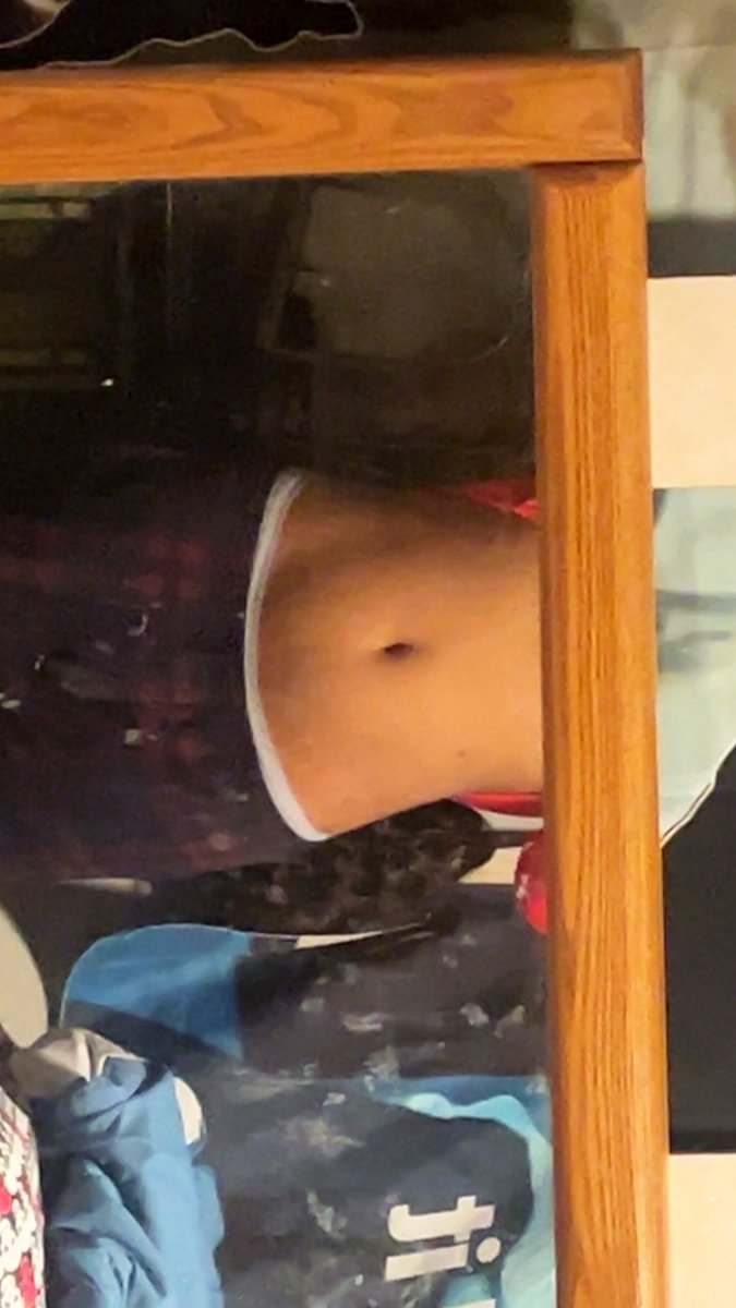 z0loft_z0mbi3zz's tweet photo. taken one year apart not sure how I could go into public like that but okay
if you reply be nice!
#bc #edtwt #bodycheck #bodychecktwt https://t.co/jWh3QY87IH