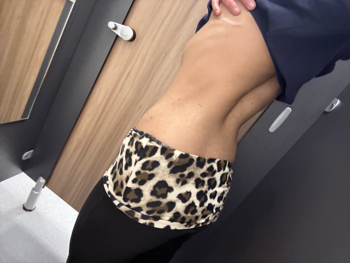 painfulcals's tweet photo. Does my back eat? https://t.co/O8ZrfNJwrY