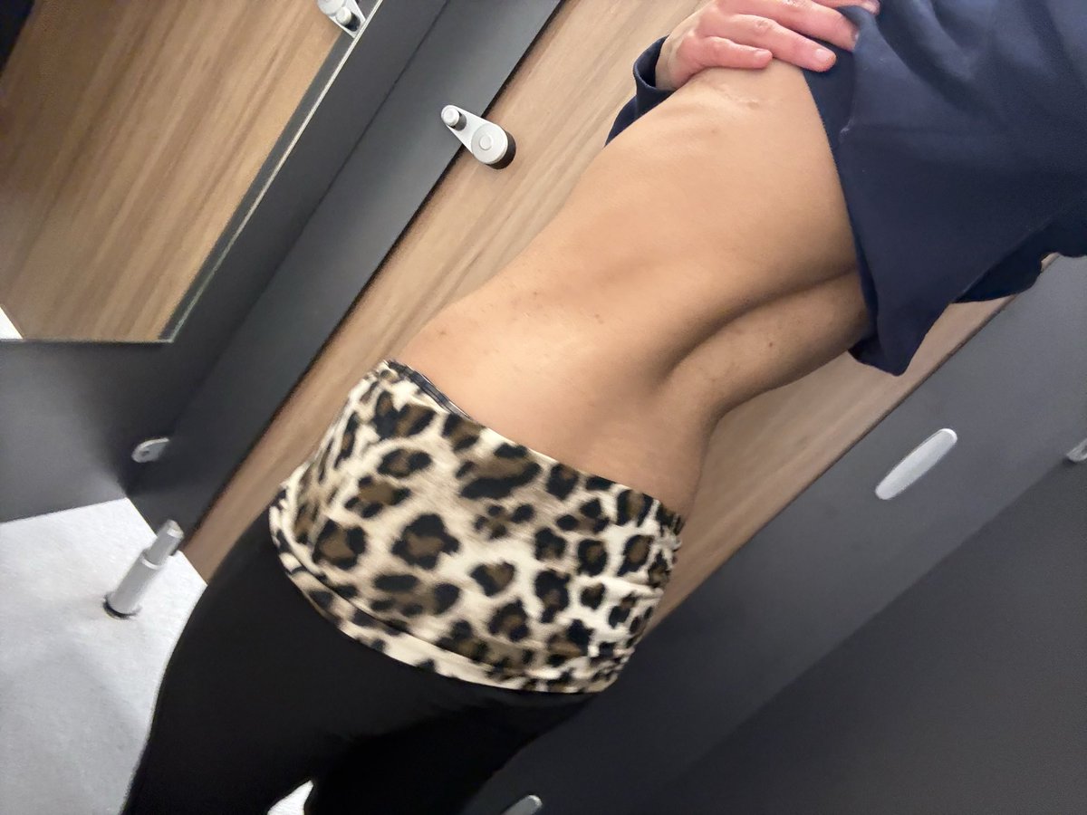 painfulcals's tweet photo. Does my back eat? https://t.co/O8ZrfNJwrY