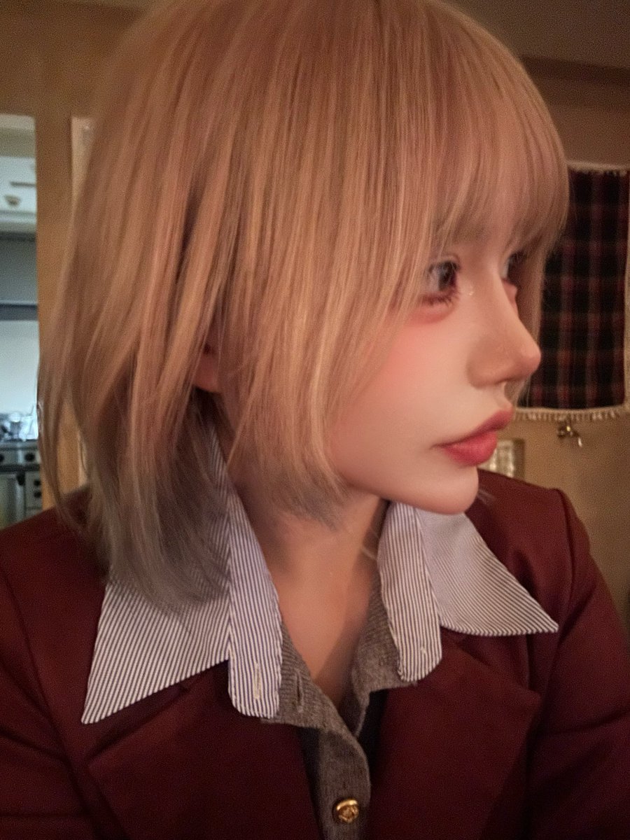vI5jm's tweet photo. リプトン美容外科(@Lift_on_skin )でオンダリフト🧏‍♀️

ほうれい線と、顎下中心に当ててもらったよ✨️カウンセリングから皮膚科の専門医が診てくれるから安心できた😮‍💨

1、2枚目のbefore afterは全部ノーマルカメラ無加工の写真なんだけど、ほうれい線消滅したし、輪郭もスッキリした！

オンダリフトする前日に他のクリニックでほうれい線が��になるって言われたんだけど、後日オンダリフトした後に行った別のクリニックではほうれい線ほとんど無くて綺麗言われたくらい術後からすぐに効果でた💓痛みも全然なかった！✨️

やっぱりたるみと顔に影が無くなるだけでめっちゃ小顔に見えるし写真も盛れて最高👀💓