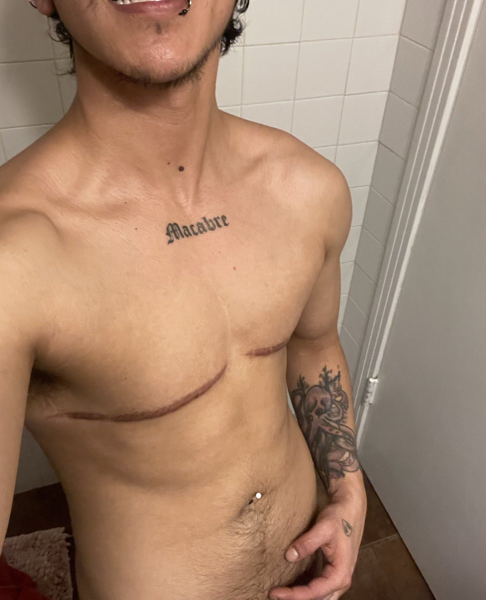 APrinceoflust's tweet photo. 181 pushups today ๐๐ช๐ค๐
Just got some new toys ๐
Videos only on Onlyfans https://t.co/c6yfHkgB4p
More teasers coming soon ๐๐ฆ
#ftm #onlyfans #transmasculine #emoboy #nonips #nsfw #lgbtq #muscles #straight #gay #bigclit #tdick #queer #chudai https://t.co/Jg7XOtAohL
