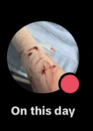 akissinner's tweet photo. hi guys its been awhile but did tiktok really have to show me cutting myself LMFAO https://t.co/lq0jKMUB3S