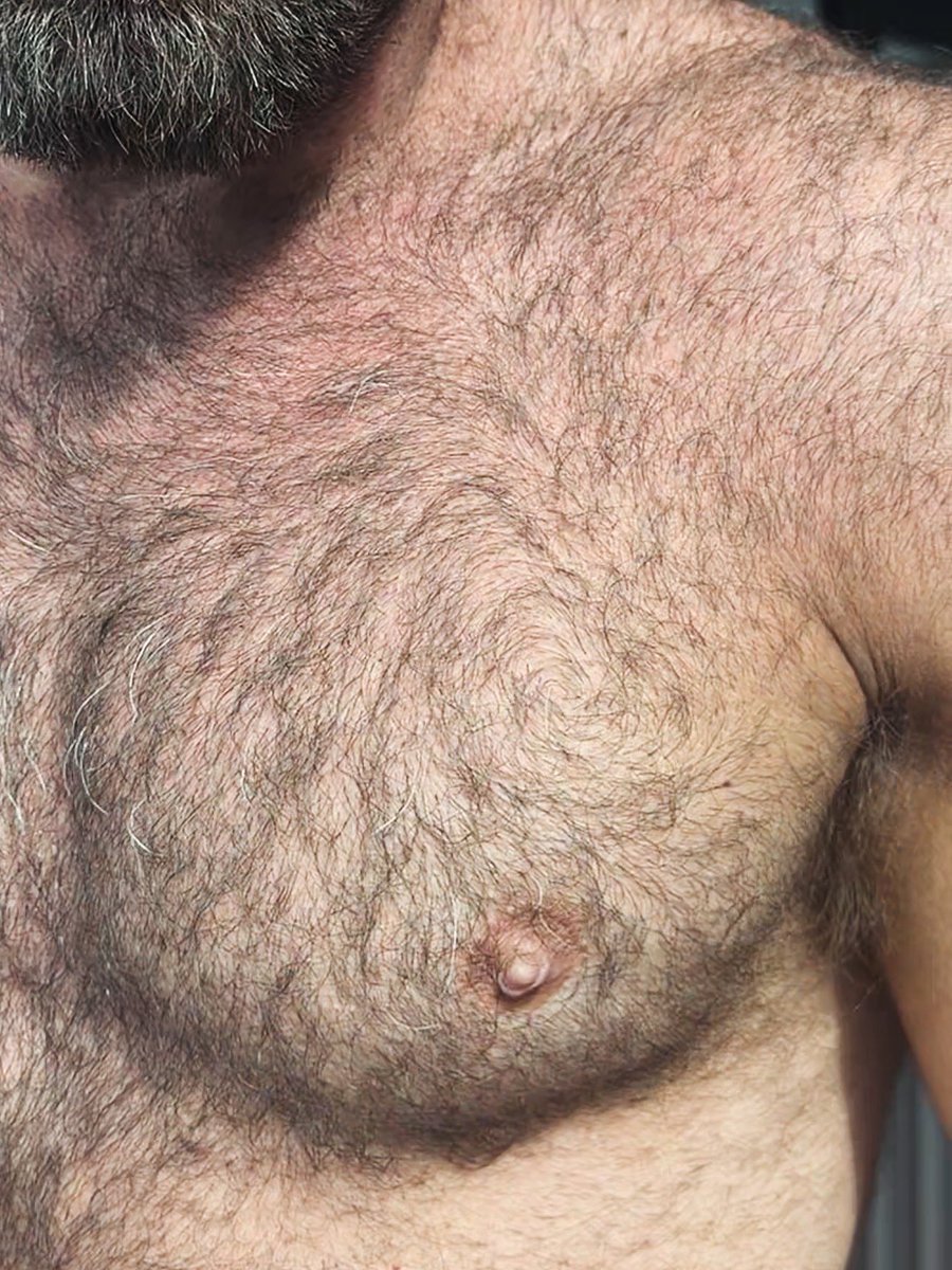 hirschy87 tweet media