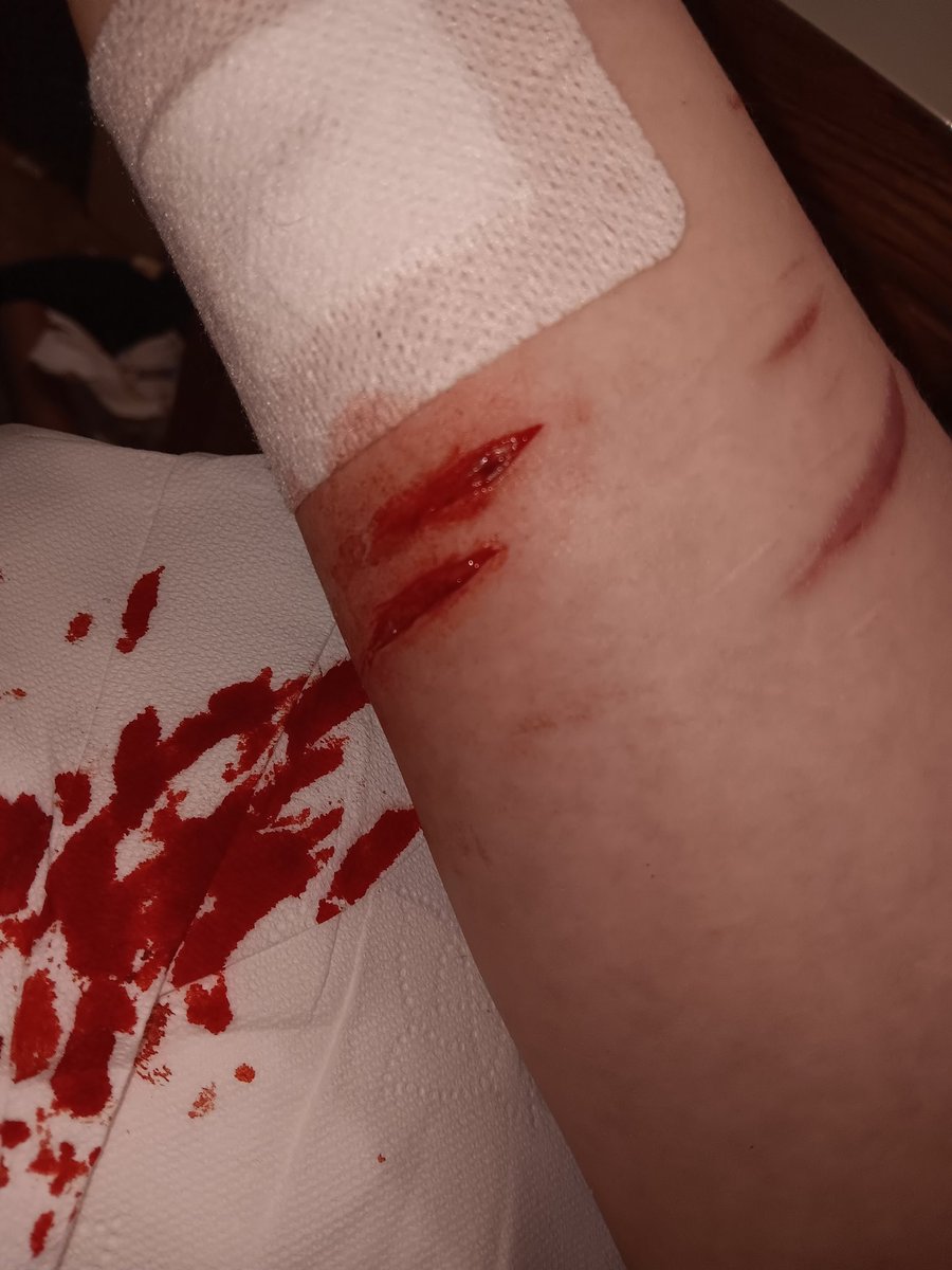 ୨ 🐇 ୧﹔ anika︐ semi active tweet media