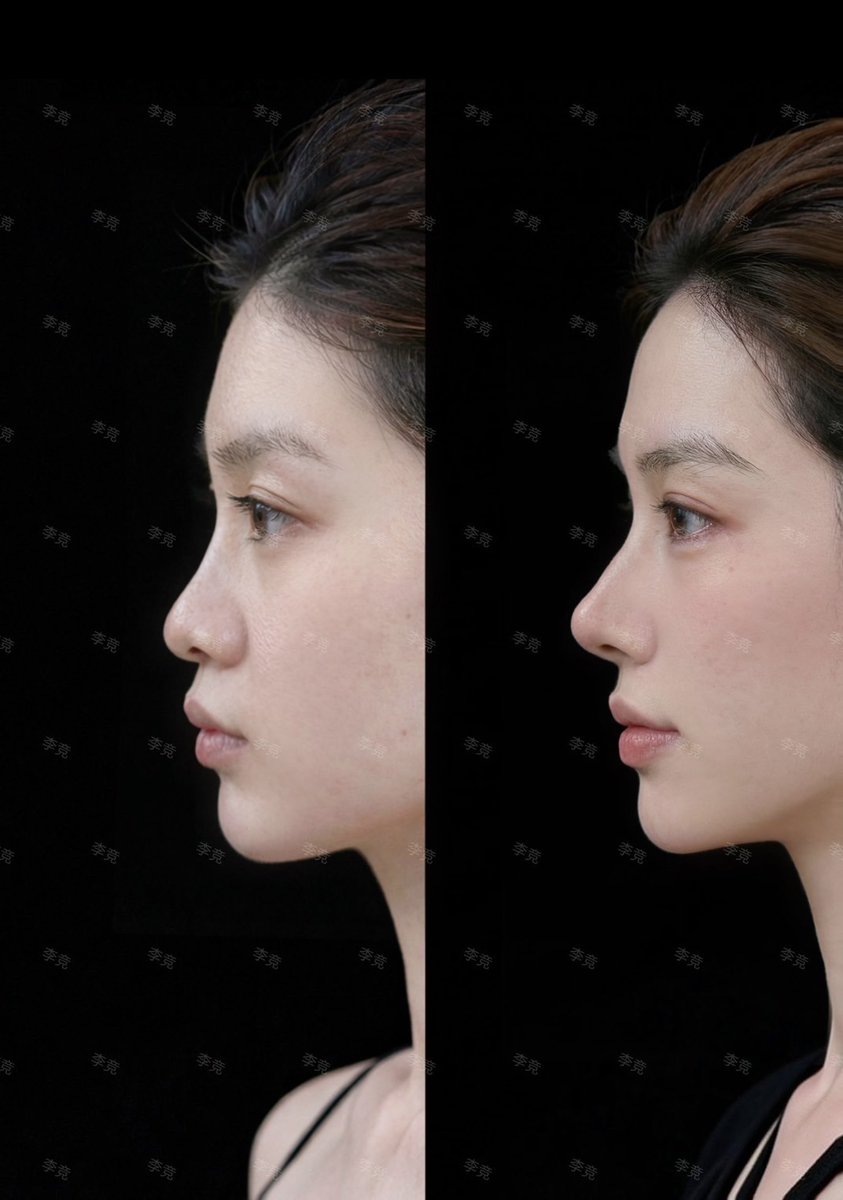 Qちゃん🫧 tweet media