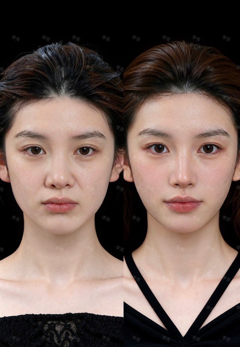 Qちゃん🫧 tweet media