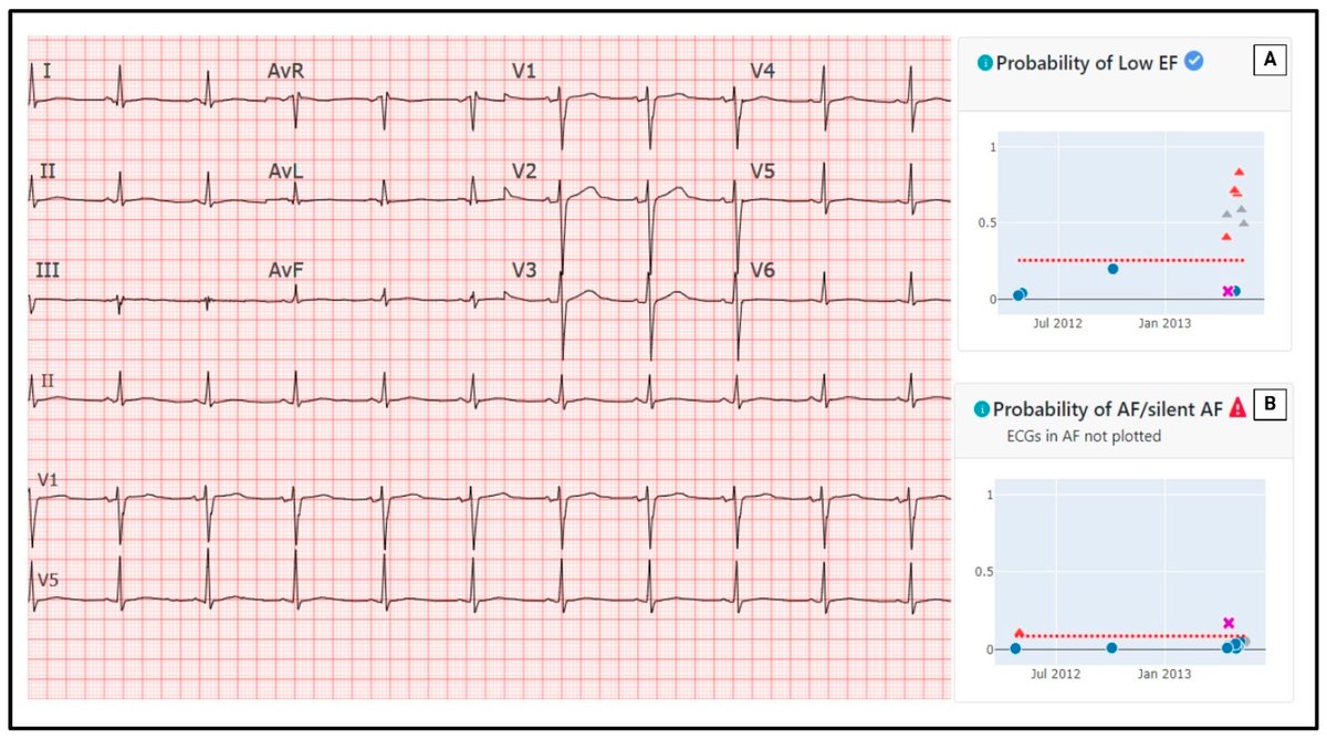 Cancers_MDPI's tweet image. 🎖️Check out the #Editor's Choice #Article
“Applications of #Artificial Intelligence for the Prediction and Diagnosis of Cancer Therapy-Related #Cardiac Dysfunction in Oncology Patients”

👋by Isabel G. Scalia, Chadi Ayoub et al. @MayoClinic

Full paper👉mdpi.com/2072-6694/17/4…