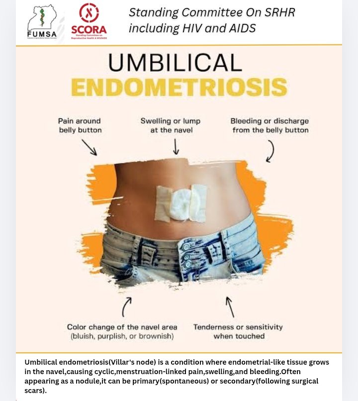 FUMSA SCORA🇺🇬 tweet media