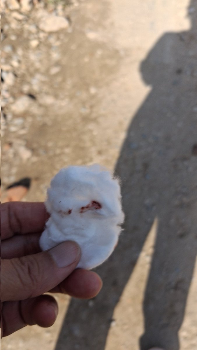 ~ ᤔᤢᤁᤢᤔ:मुकुम ~ tweet media