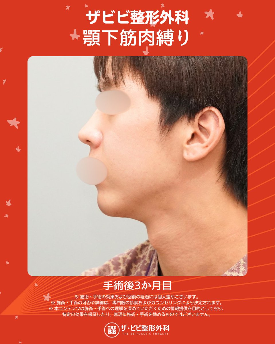 韓国整形🖤ザビビ整形外科 tweet media