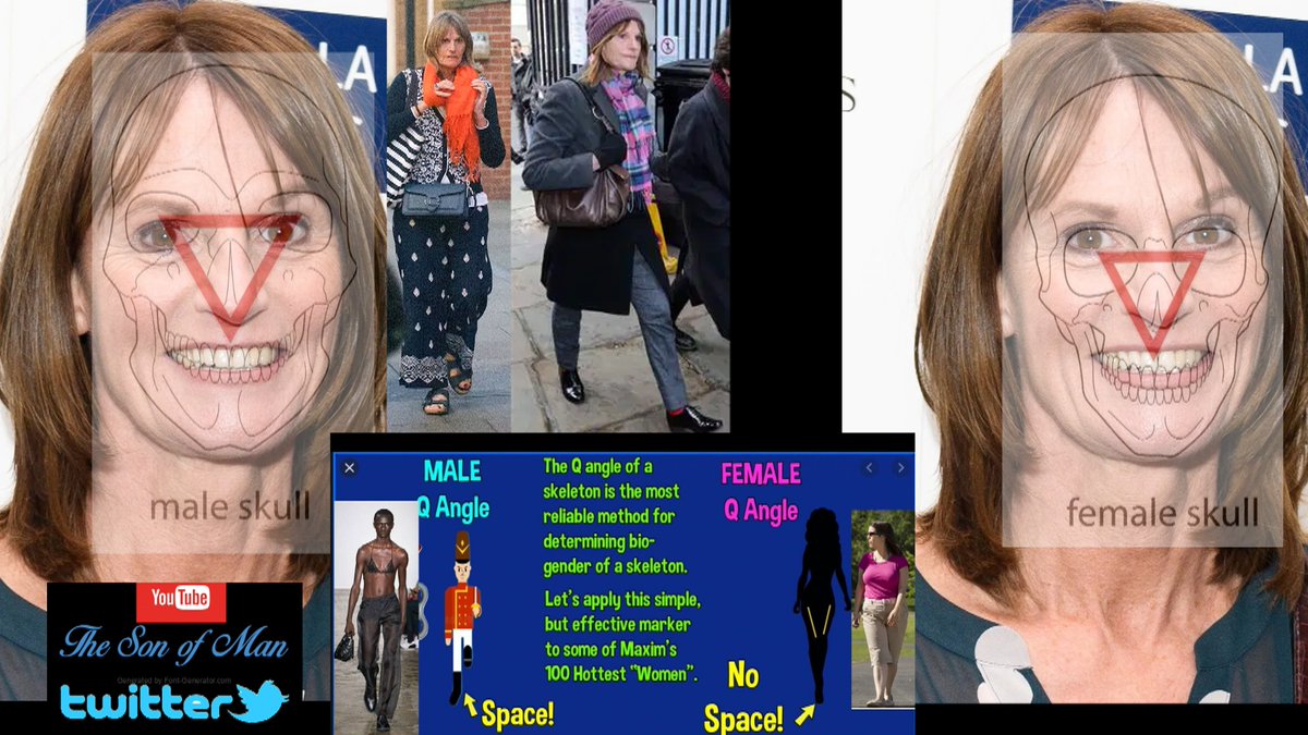 TheSono71468392's tweet image. Gwyneth Strong fails the Forensic tests/Bio male skull 2x the MALE gait/straight legs/knees together/feet forwards/with a SPACE/but Fanx for playing CSi with me #forensics #CSI #EGI                                 
                     ~  Its ALL of them ..No Exceptions
