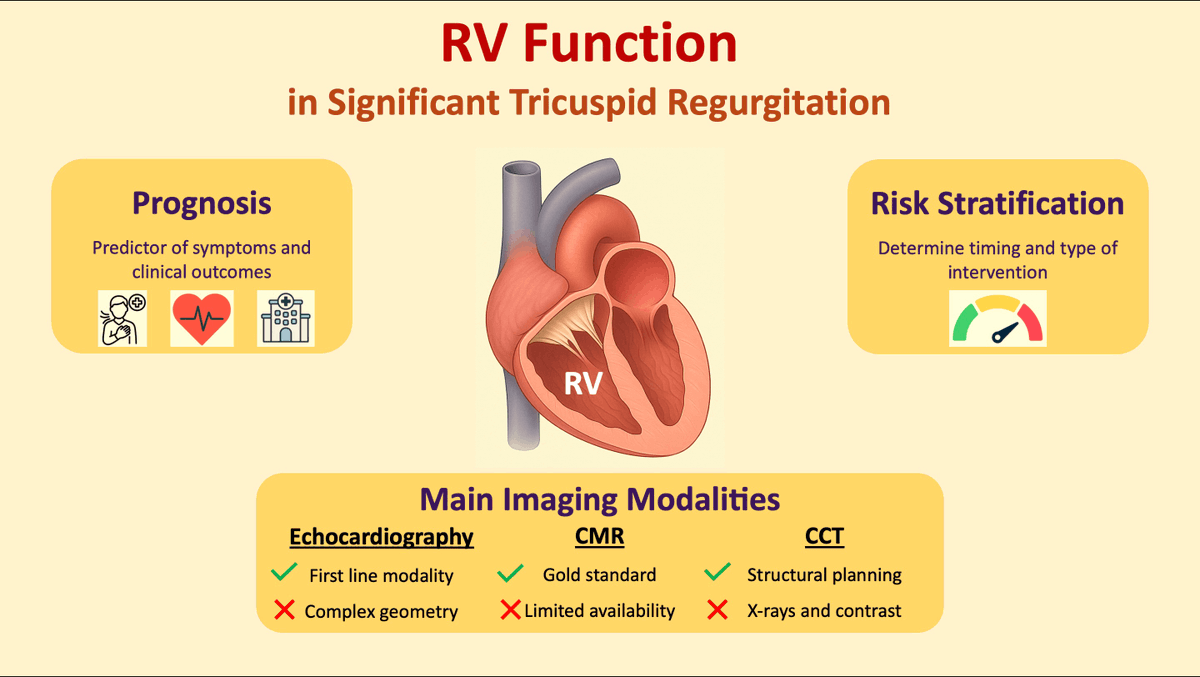 SusieSu11733465's tweet image. How does right ventricular function shape outcomes in significant tricuspid regurgitation?
💡This review highlights its key role in symptoms, intervention timing, and prognosis.

#tricuspidvalve #ventricular #tricuspidregurgitation #TR #RV 

Read more👉:
imrpress.com/journal/RCM/27…