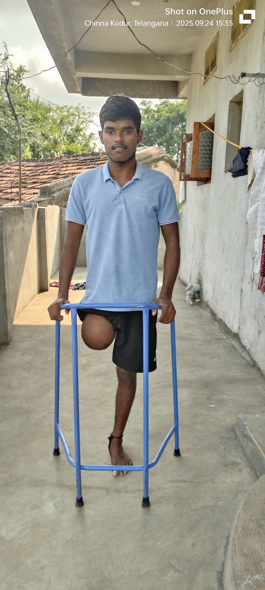 Radarambab89381's tweet photo. @revanth_anumula Respected  Sir,  🙏
 Vorkol Ranjith  (23 years old) fromPeddakodur , Chinnakodur, Siddipet  lost his leg in a road accident.I humbly request your kind support to help arrange a plastic/prosthetic leg for him.
Hoping for your kind help, Sir. 🙏 https://t.co/1Vu8CBTAJj