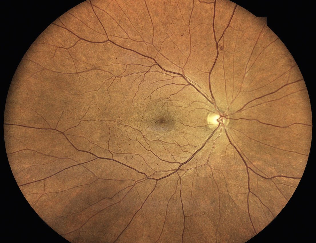 OptometricManagement tweet media