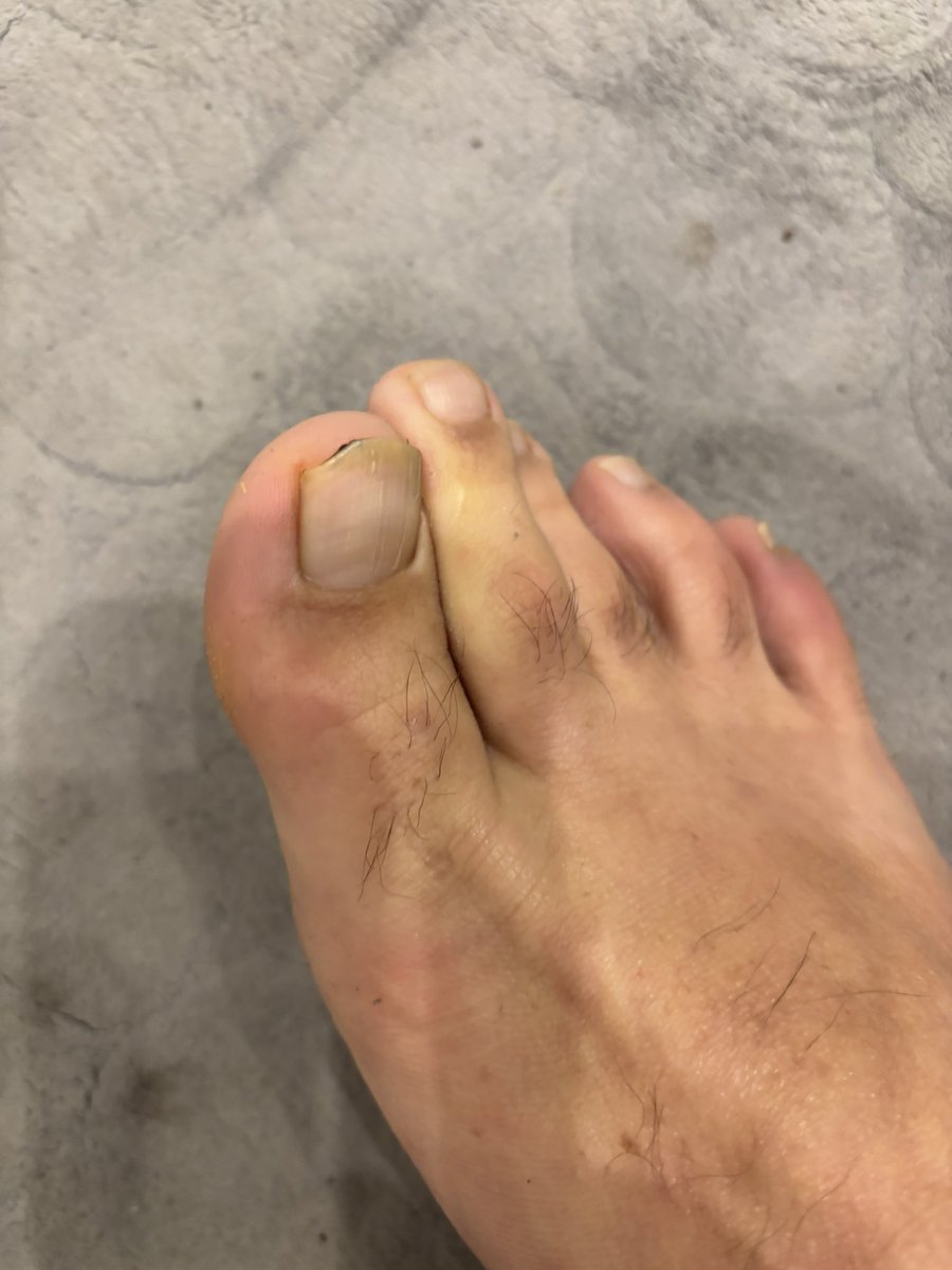 Italianbull🇩🇪🇮🇹 tweet media