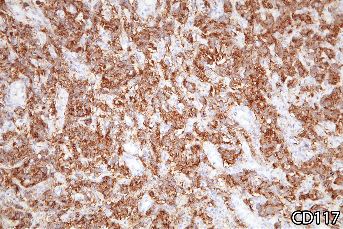 Surgical Pathology Cases tweet media