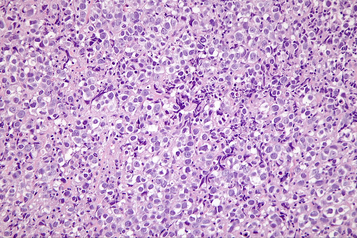 Surgical Pathology Cases tweet media