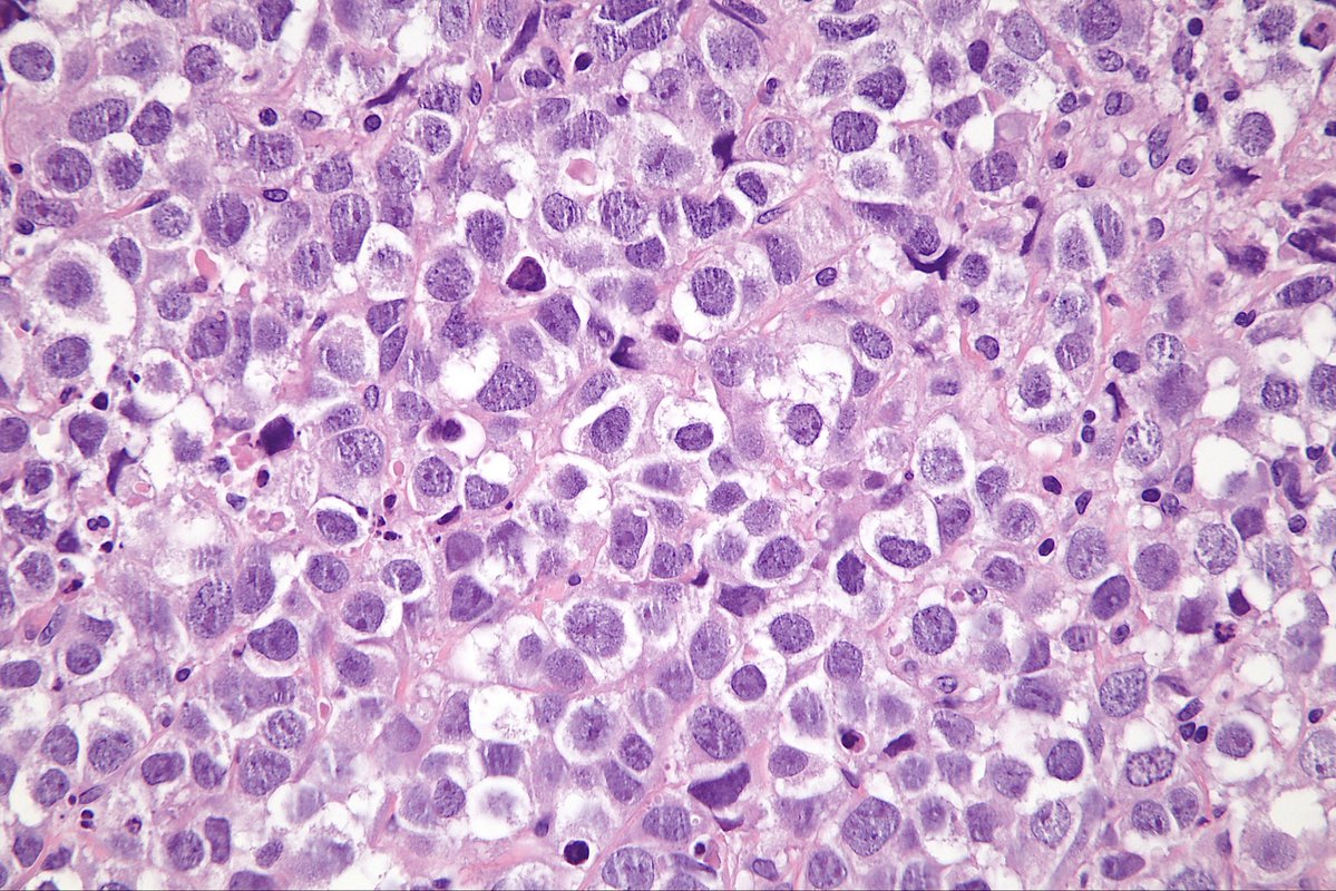 Surgical Pathology Cases tweet media