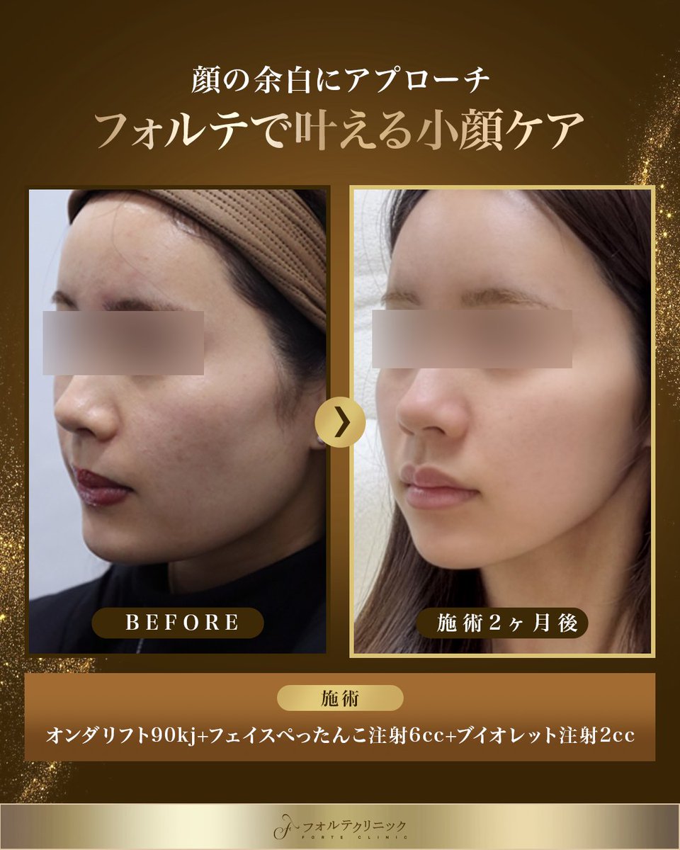 韓国美容 フォルテクリニック【公式】 tweet media