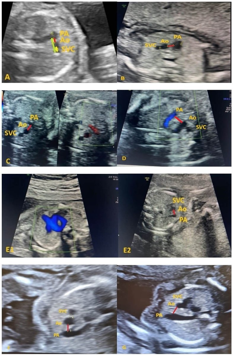Clinical and Experimental Obstetrics & Gynecology tweet media
