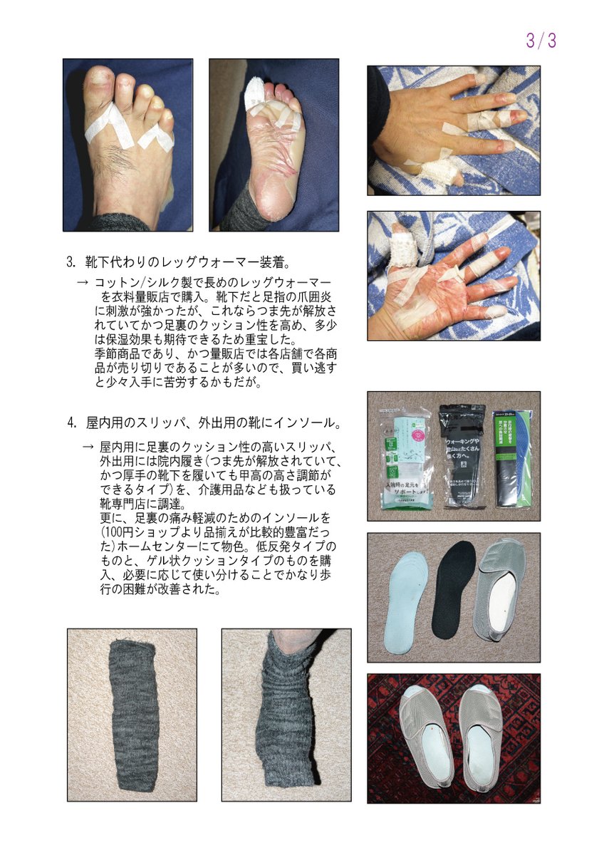 makura_dEmile's tweet photo. 手術後の化学療法(Capox)4クールもどうにか終了。オタ終活の猶予期間が得られたのは嬉しいｗ
最もキツかった(現在進行形だが)副作用が手足症候群で、防止に比べ対処法についての具体的な情報が少なく、自分で模索した結果を一応残しておく。同じ痛みに悩む同志に届けばと。
#がんサバイバー #抗がん剤 https://t.co/p0zy8t3WHK