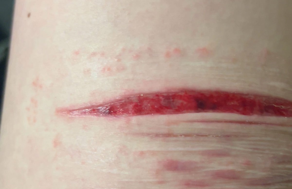 Xixi 。°(°¯᷄◠¯᷅°)°。 tweet media