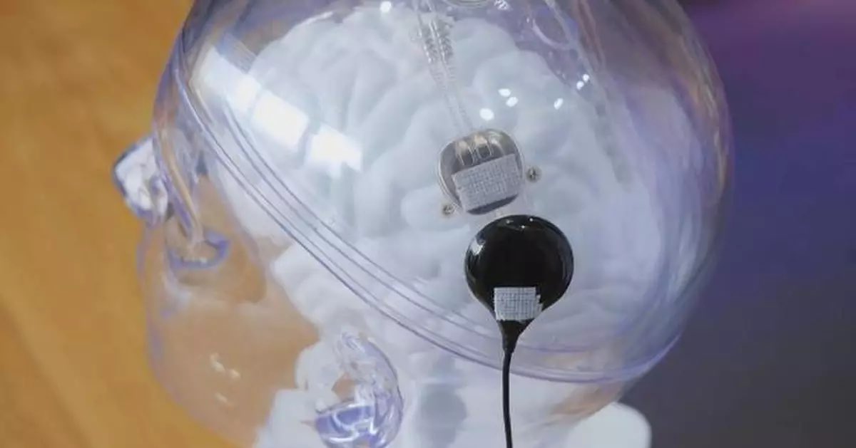 BREAKING🚨: China just approved the world’s first commercial brain ...
