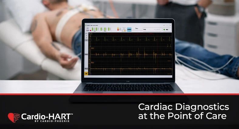 AI is transforming how heart disease is detected.
New AI cardiac diagnostic devices like Cardio-HART are bringing advanced cardiac diagnostics directly into primary care — enabling earlier detection and smarter referrals.
shorturl.at/2tUdv 
#Cardiology #MedTech