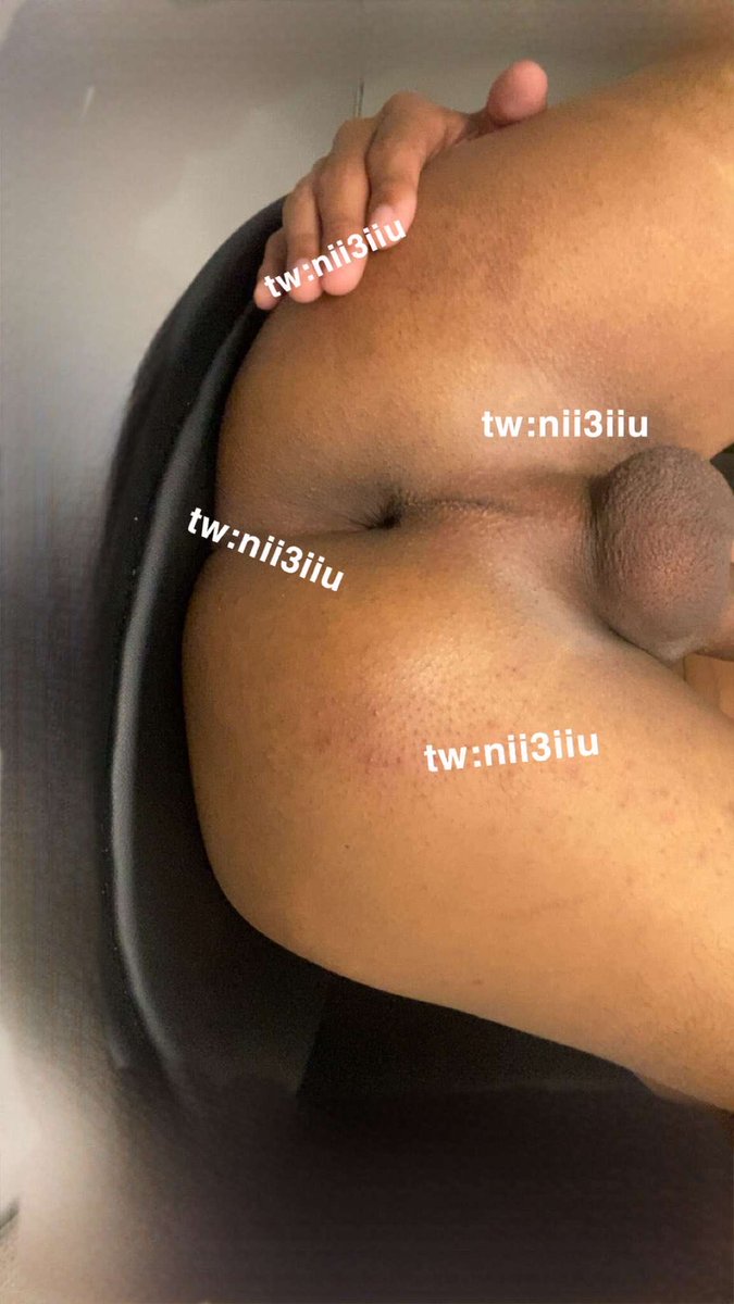 OSCAR 🍷 tweet media