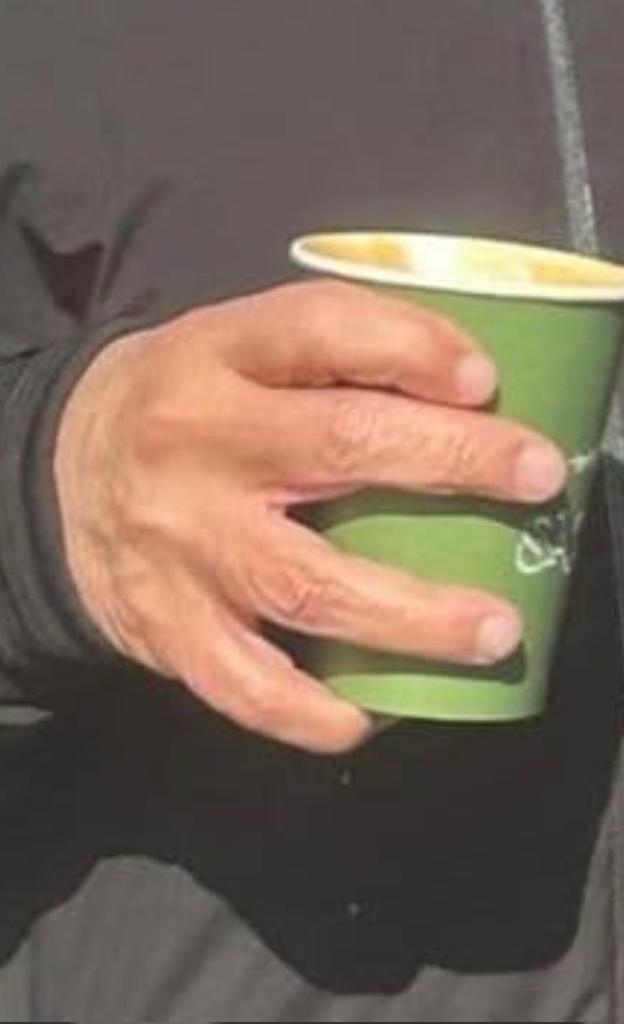 It's AI generated, 2 midle fingers looked wrinkle but others looking smooth 😂