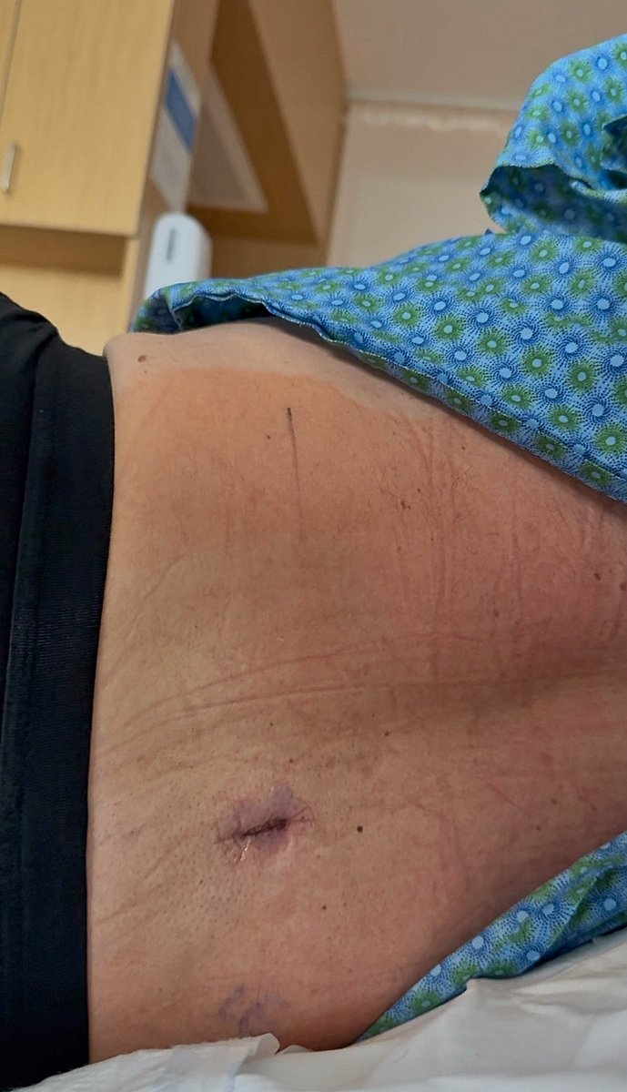 Nicholas Butchart tweet media