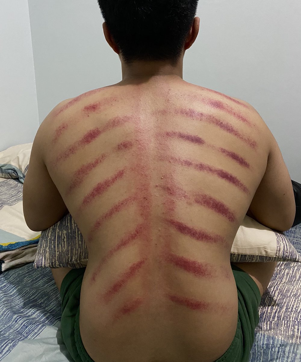 FM♏️ tweet media