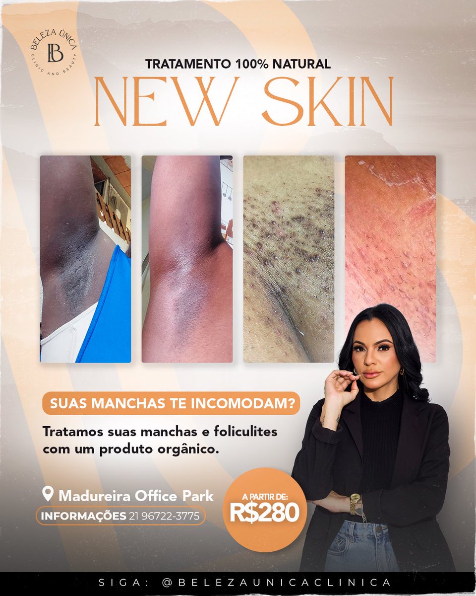 NeresDepil's tweet photo. Ainda na semana do consumidor!
Tratamento com até 20% de desconto até dia 30/03.
WhatsApp 21967223775 https://t.co/UFEFnpwOsd