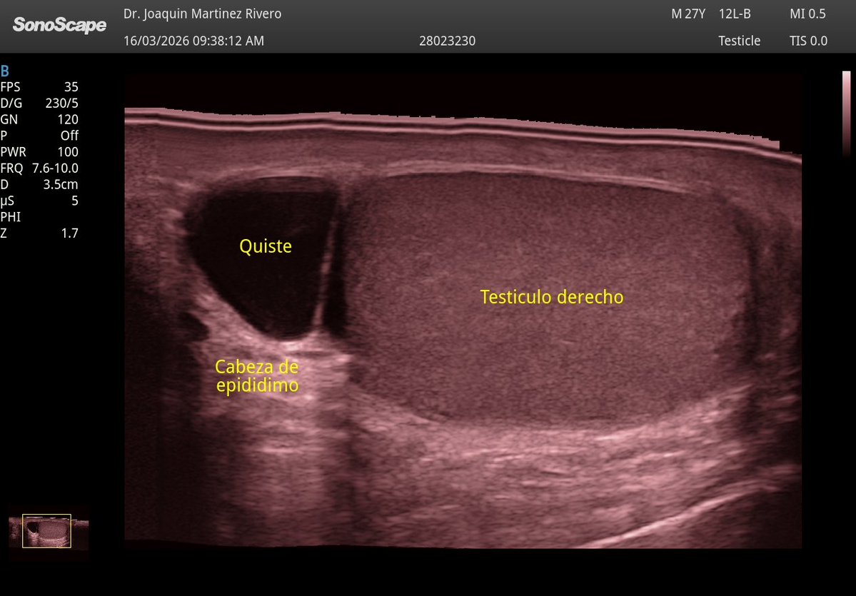 Joaquín Martínez tweet media