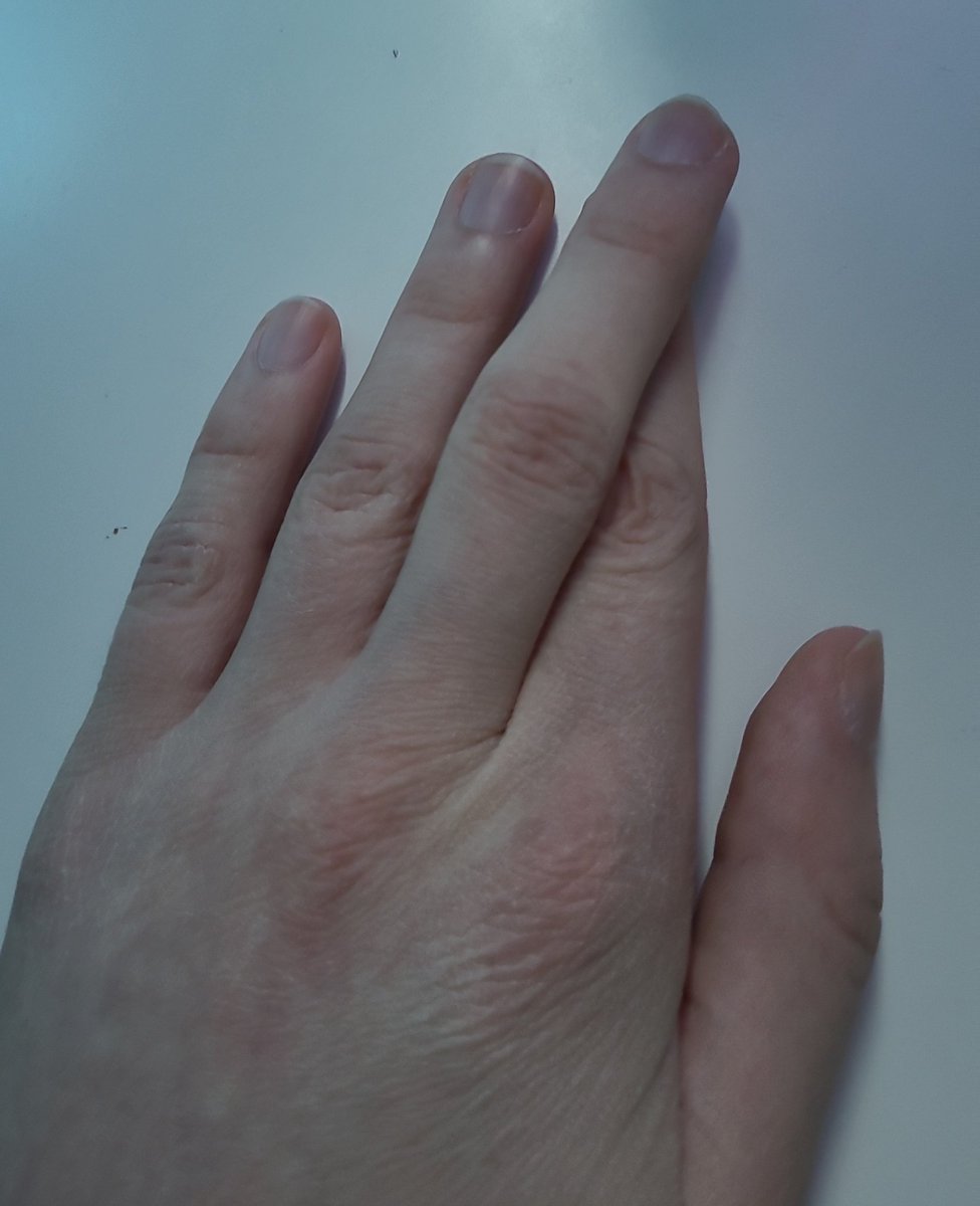 Service Liyo🔞🇳🇱 tweet media