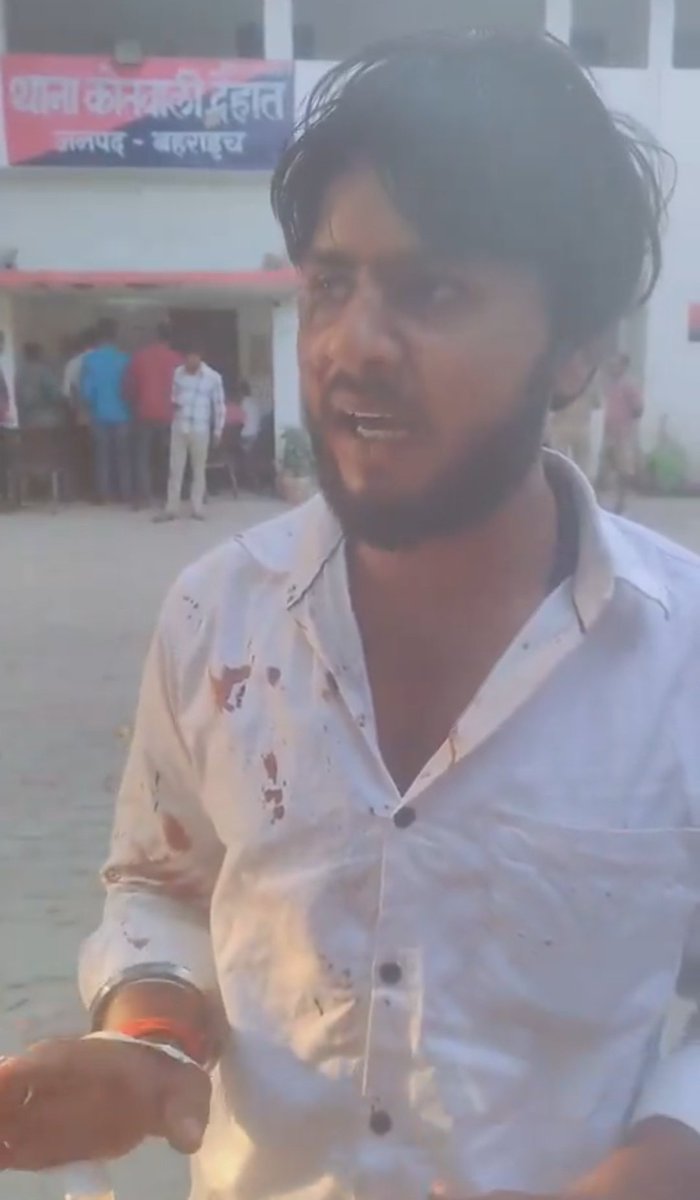 मैं यूजीसी का विरोध कर रहा था, कल हमें अरेस्ट करके देहात कोतवाली बैठाया गया, जब अगले दिन मैं कालेज गया तो कुछ लोगों ने षड्यंत्र करके हमारे उपर जानलेवा हमला किया की तुम बहुत यूजीसी का विरोध कर रहे हो। तुम्हारे अंदर सवर्ण समाज का कीड़ा काट रहा है।

फिर मेरे चाकू से जानलेवा हमला