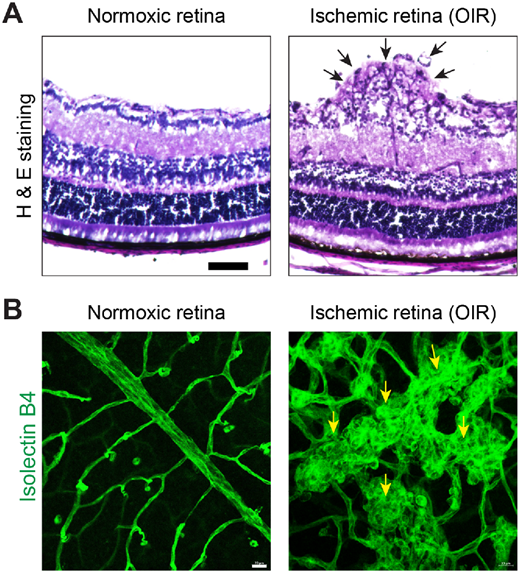 IOVS Journal tweet media