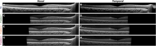 TVST Journal tweet media