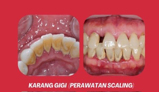 Warga Unhas tweet media