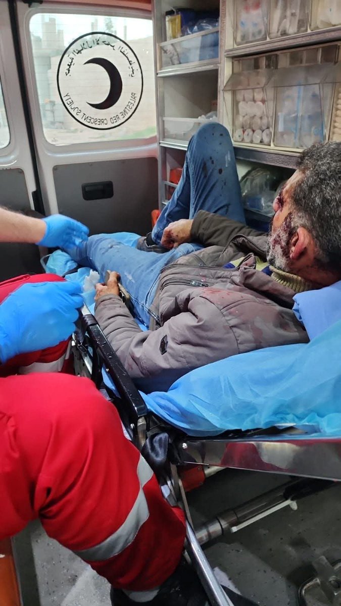 إصابة راعي أغنام فلسطيني بجروح ورضوض؛ جراء اعتداء مستوطنين عليه، في أراضي بلدة قراوة بني حسان، غرب سلفيت.