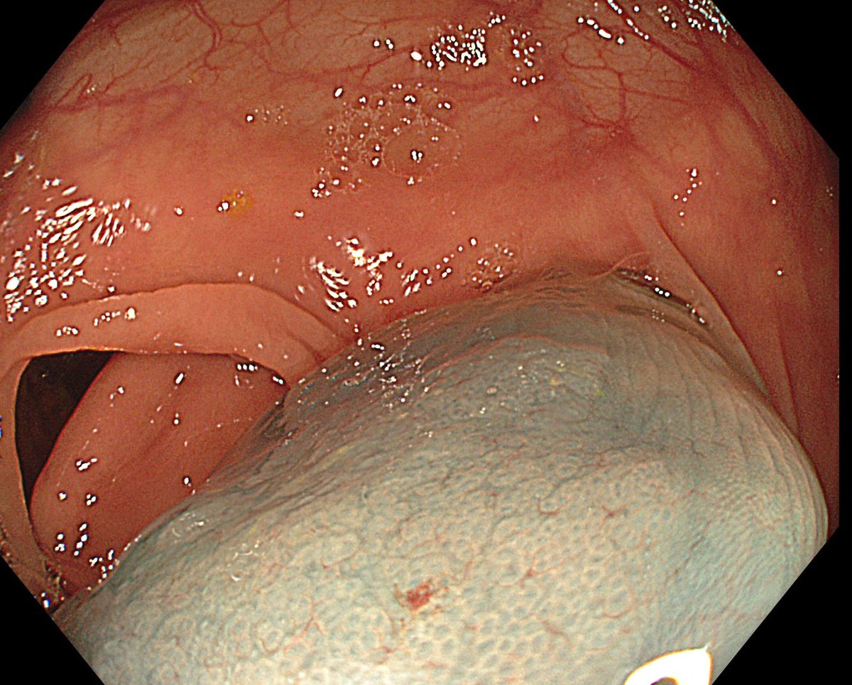 Aleksandar Gavric tweet media