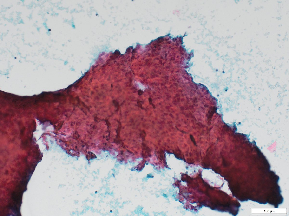 Philippe Stephenson, MD tweet media