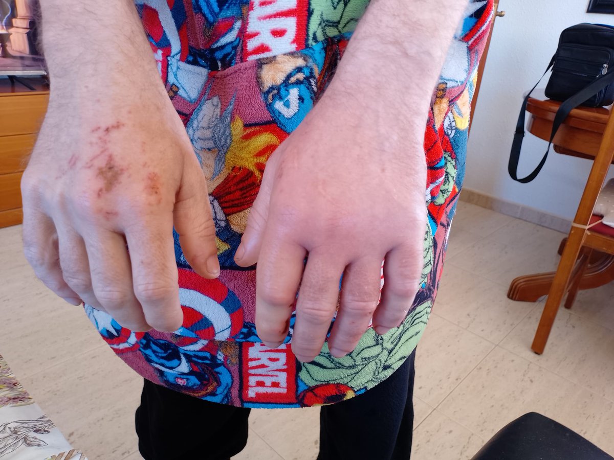 Andtres & Lukas tweet media