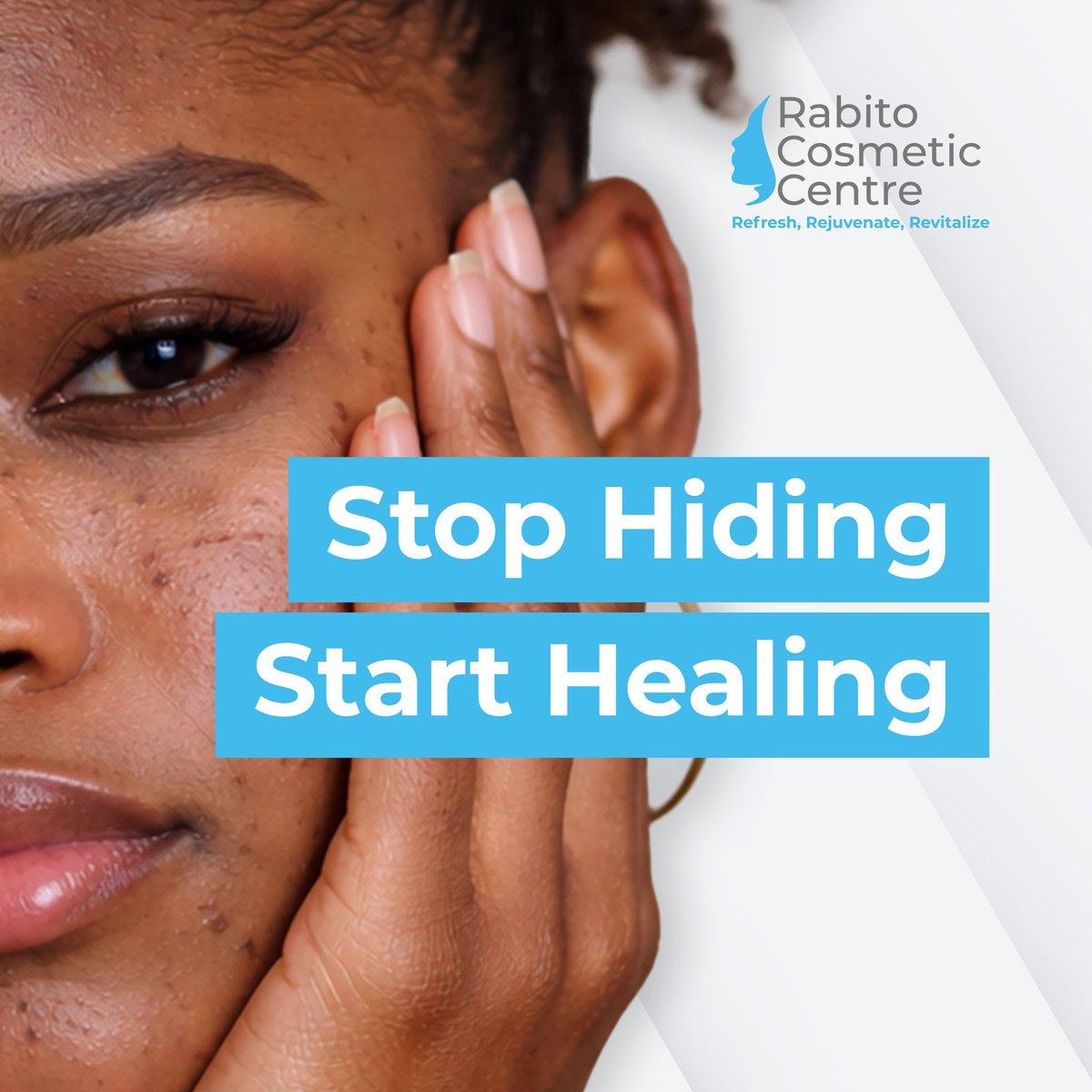 Stop hiding your skin. Start healing it.

Skin concerns like acne, dark spots, and uneven texture can affect your confidence, but you don’t have to face them alone.

our experts provide professional skin analysis and safe treatments for lasting results

Call us on 0559740593 book