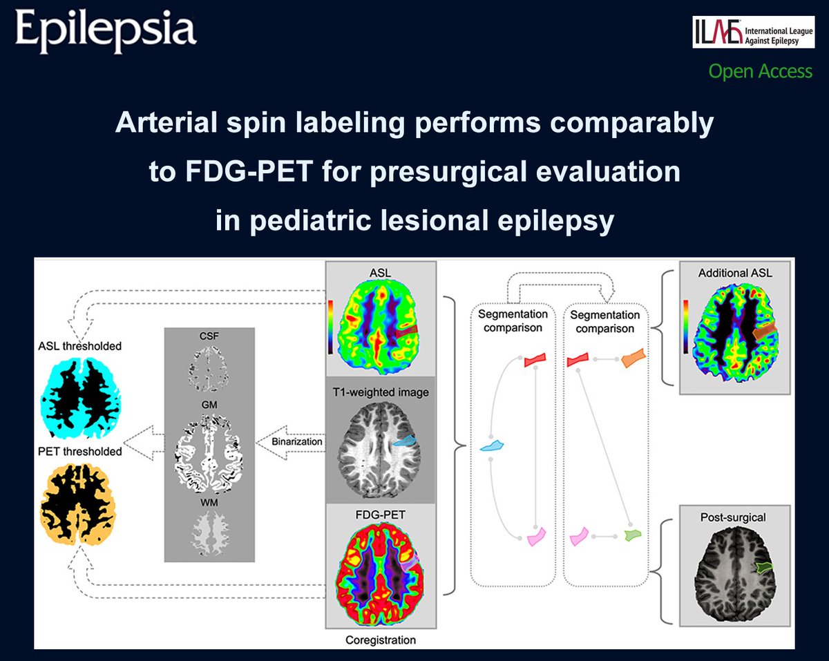 EpilepsiaJourn's tweet photo. ASL MRI shows perilesional findings equivalent to FDG-PET in pediatric lesional epilepsy, supporting it as a radiation-free alternative.
https://t.co/ANLQn2S1ig 

#epilepsy #ILAE #epilepsiajourn #epilepsysurgery #imaging #MRI #pediatricfocallesionalepilepsy #PET https://t.co/NhD9wcv6GC