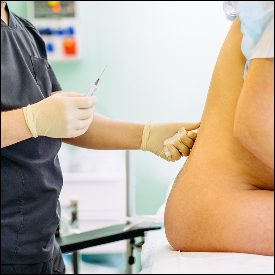 _Anesthesiology's tweet photo. In a newly published article, Furdyna et al. sought to delineate the frequency, risk factors, etiology, and management of peripartum, perianesthetic maternal cardiac arrest in a large, contemporary U.S. cohort.

📕 Read the article: https://t.co/ZBIIfY6ubx https://t.co/IJYTiPYsHS