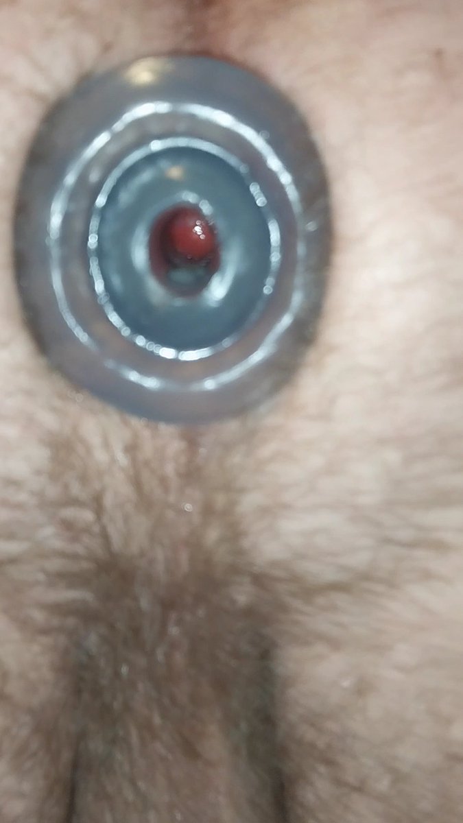 Jonboy1954 tweet media