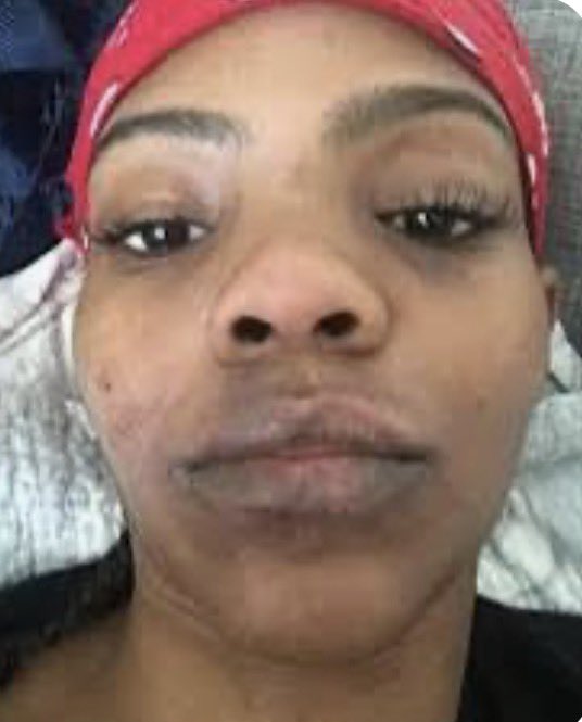 JBloiseDrops tweet media