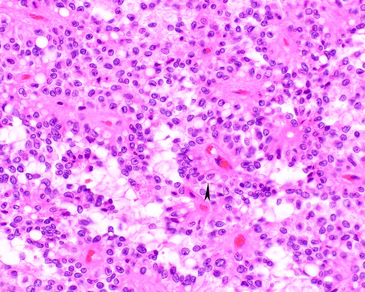 Modern Pathology tweet media