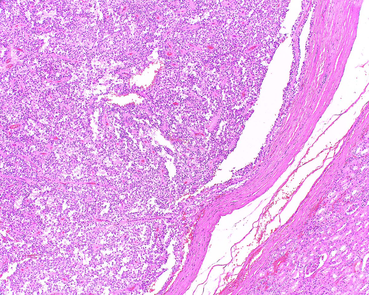 Modern Pathology tweet media